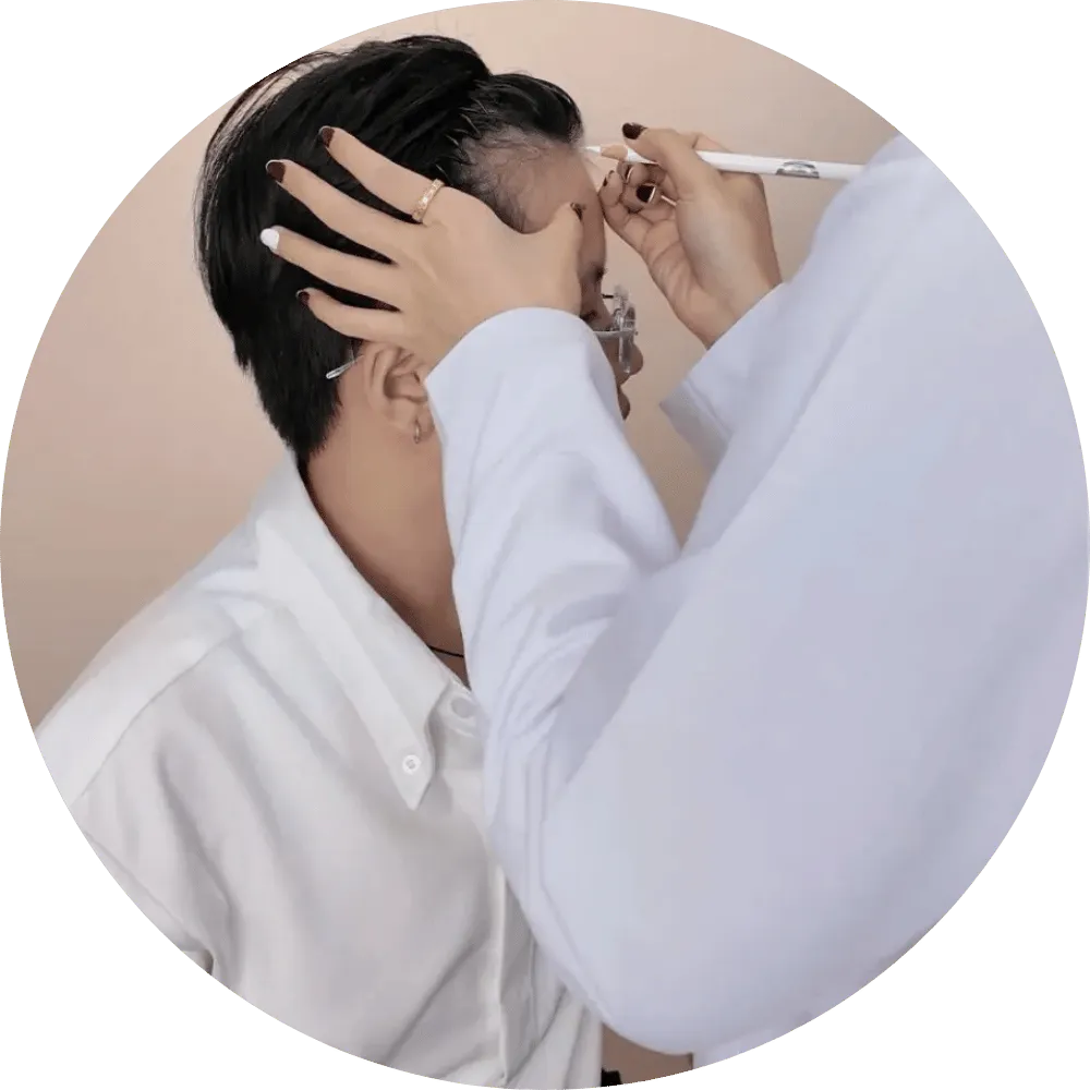 Cấy tóc tự thân