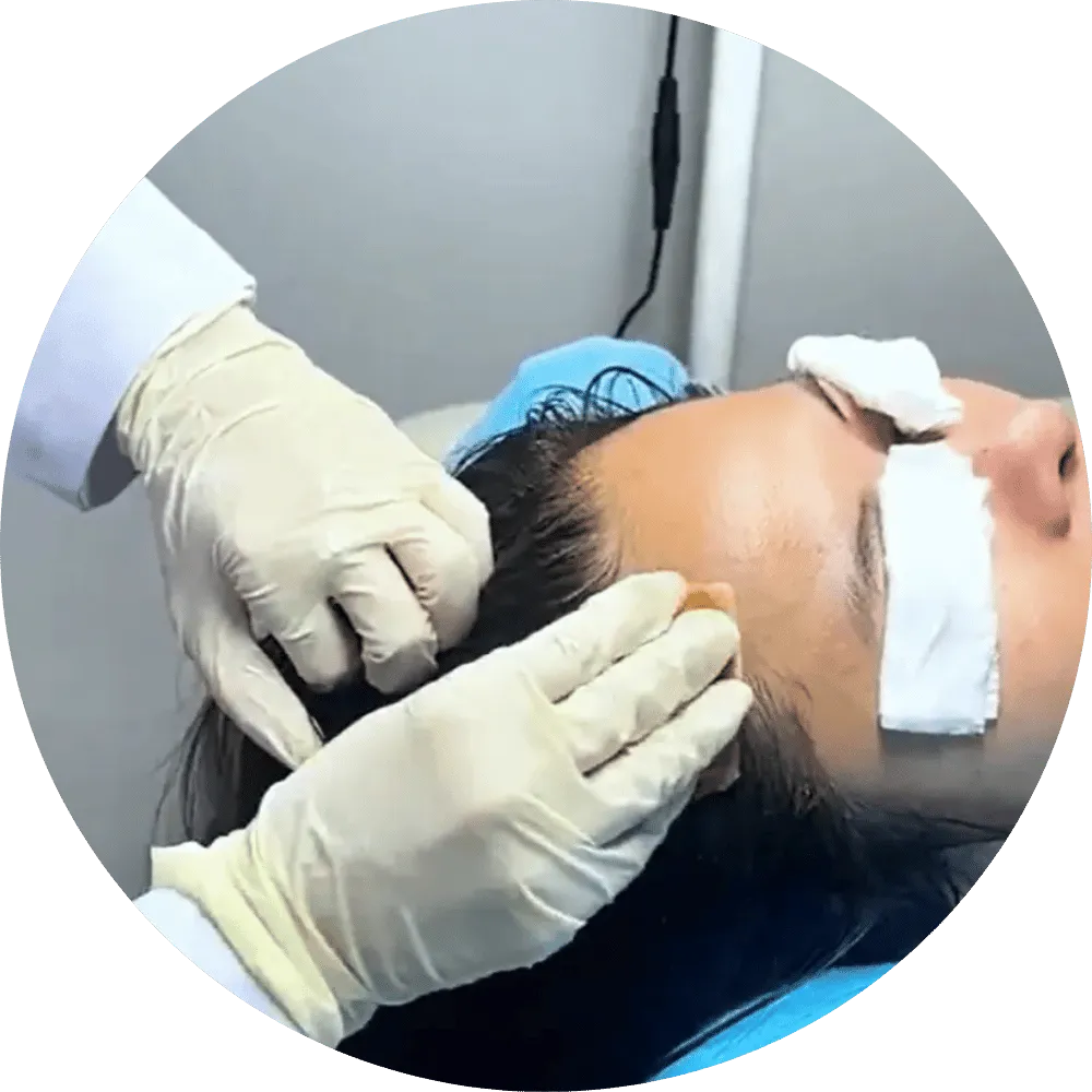 Chăm sóc điều trị tóc