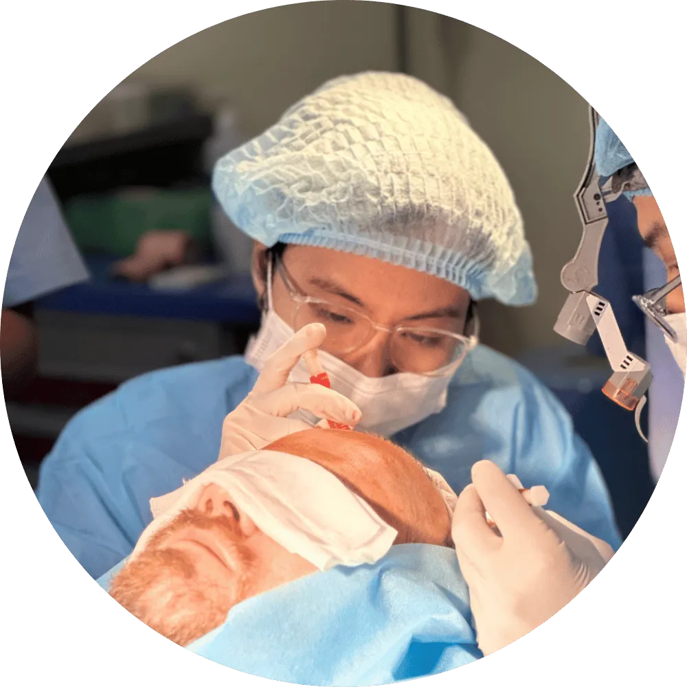 Cấy tóc tự thân