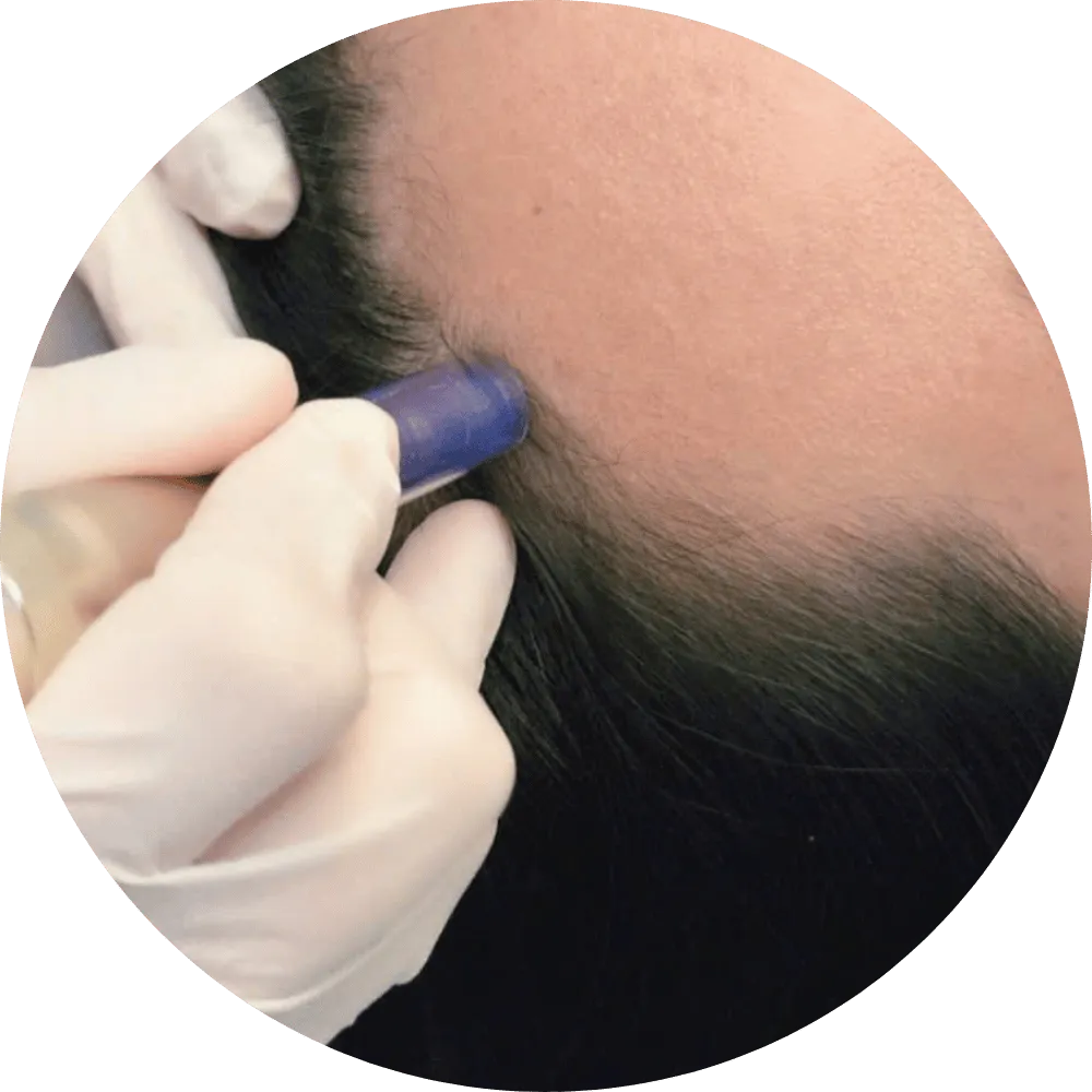 Chăm sóc điều trị tóc