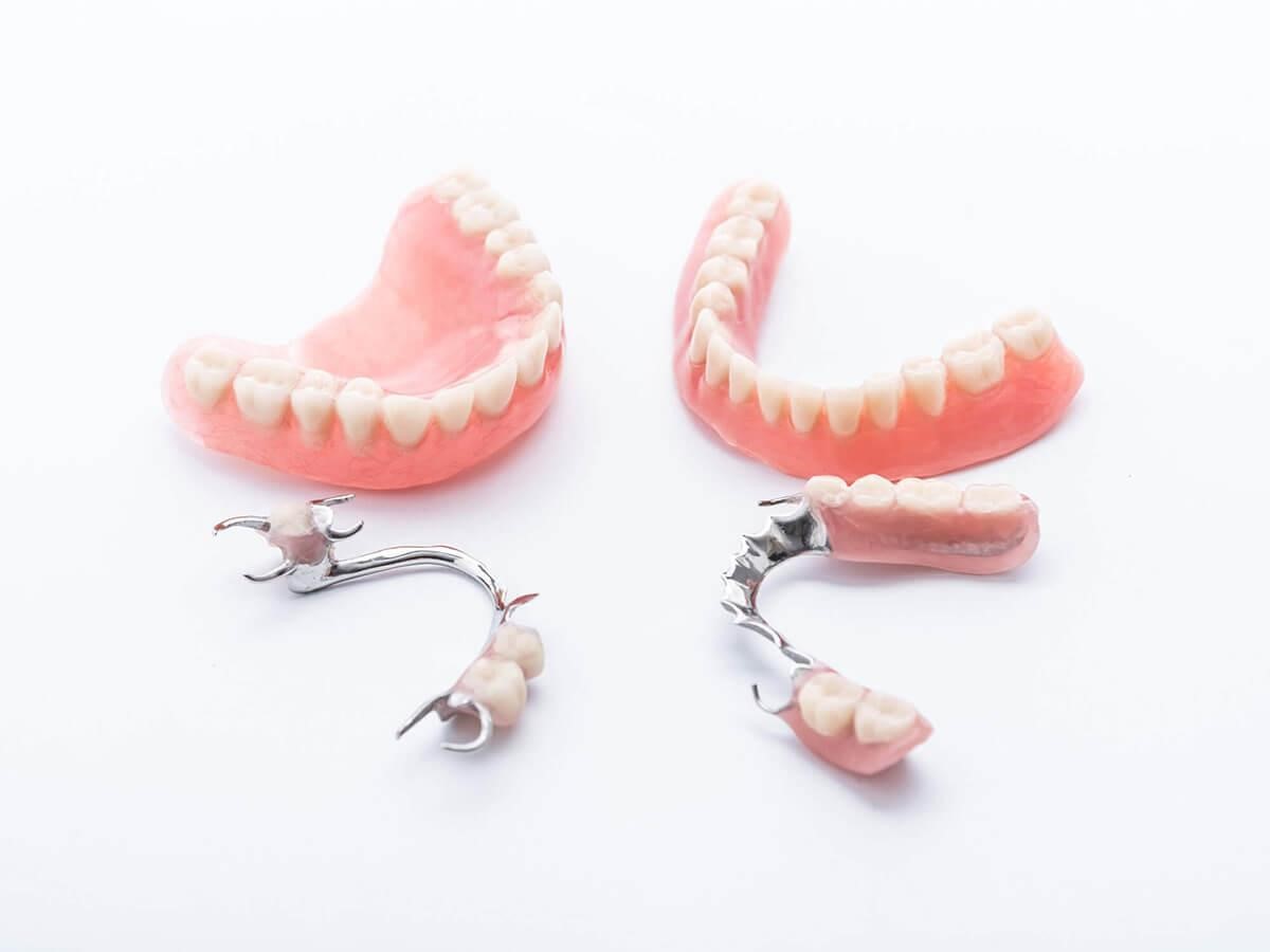 NGƯỜI CAO TUỔI NÊN LÀM HÀM THÁO LẮP HAY IMPLANT?