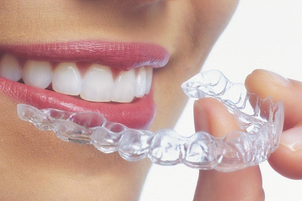 KHÔNG PHẢI KHAY NÀO CŨNG LÀ INVISALIGN – KHÁC BIỆT NẰM Ở CÔNG NGHỆ PHÍA SAU