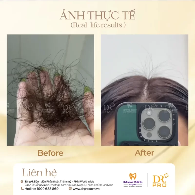 Chăm sóc điều trị tóc