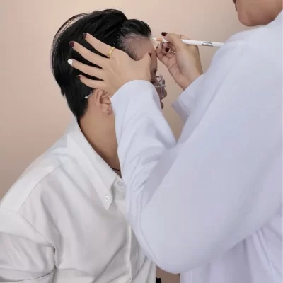 Cấy tóc tự thân DHI - Giải pháp cải thiện mật độ tóc và đường chân tóc tự nhiên Thiết kế vung cấy tóc