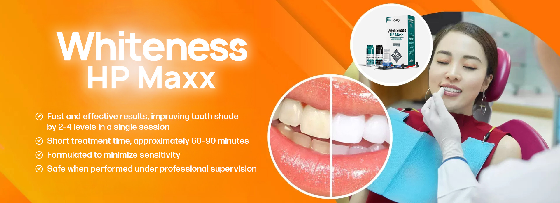 teeth whitening