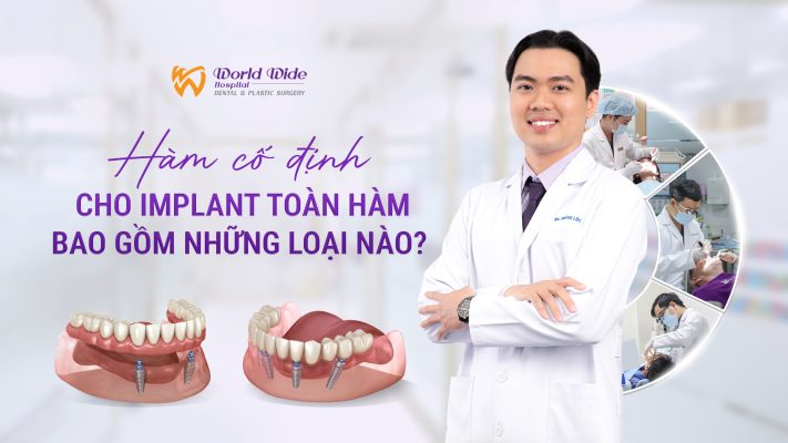 hàm cố định cho implant toàn hàm