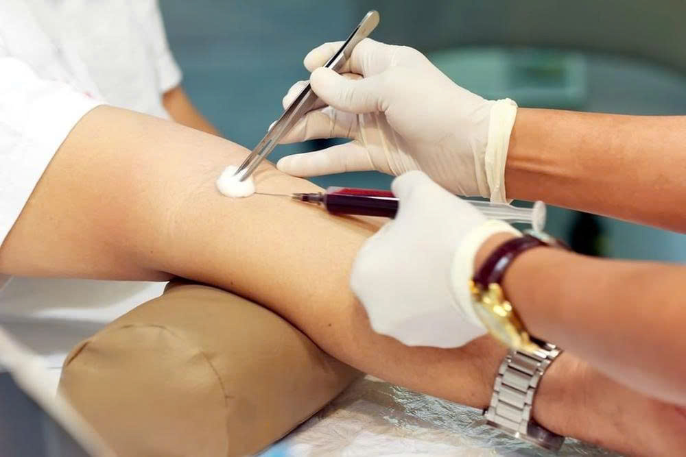CÁC LOẠI XÉT NGHIỆM CẦN LÀM TRƯỚC KHI THỰC HIỆN PHẪU THUẬT GÂY MÊ