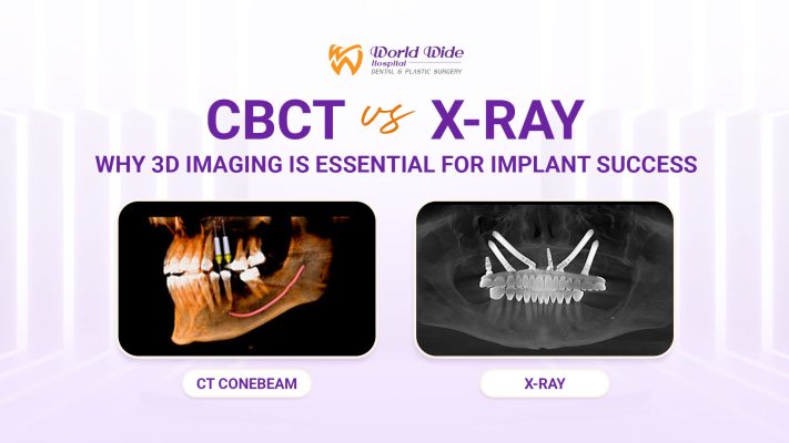 CBCT vs X-Ray
